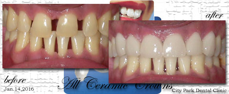 Smile Makeovers:Phuket Dental Clinic